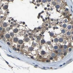 Immunohistochemical staining of human testis using Anti-FHIT antibody HPA018840.