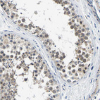 Anti-LIAS Antibody