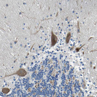 Anti-LIAS Antibody