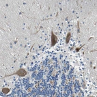 Immunohistochemical staining of human cerebellum shows moderate cytoplasmic positivity in Purkinje cells.