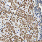 Immunohistochemical staining of human prostate shows moderate cytoplasmic positivity in smooth muscle cells.