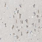 Immunohistochemical staining of human hippocampus shows weak cytoplasmic positivity in neurons.