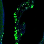 Immunofluorescence staining of mouse lateral ventricle shows positivity in a subset of cells in choroid plexus and lateral ventricle wall.