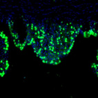 Anti-LIAS Antibody