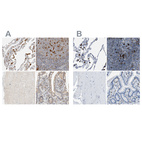 Immunohistochemical staining of human lung, lymph node, skeletal muscle and small intestine using Anti-CAPG antibody HPA018843 (A) shows similar protein distribution across tissues to independent antibody HPA019080 (B).