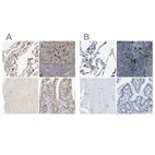 Immunohistochemical staining of human lung, lymph node, skeletal muscle and small intestine using Anti-CAPG antibody HPA018843 (A) shows similar protein distribution across tissues to independent antibody HPA019080 (B).