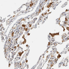 Immunohistochemical staining of human lung shows moderate to strong cytoplasmic positivity in macrophages.