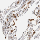 Immunohistochemical staining of human lung shows moderate to strong cytoplasmic positivity in macrophages.