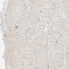 Immunohistochemical staining of human skeletal muscle shows negative to very weak positivity in myocytes.