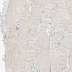 Immunohistochemical staining of human skeletal muscle shows negative to very weak positivity in myocytes.