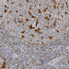 Immunohistochemical staining of human lymph node shows moderate to strong cytoplasmic positivity in macrophages.