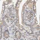 Immunohistochemical staining of human small intestine shows moderate to strong cytoplasmic positivity in cells in lamina propria.