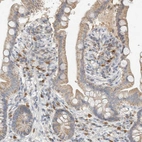 Immunohistochemical staining of human small intestine shows moderate to strong cytoplasmic positivity in cells in lamina propria.