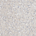 Immunohistochemical staining of human liver shows no positivity in hepatocytes as expected.