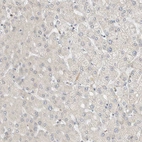 Immunohistochemical staining of human liver shows no positivity in hepatocytes as expected.