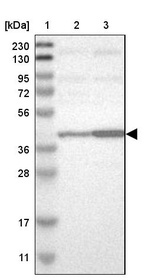 Lane 1: Marker [kDa] 230, 130, 95, 72, 56, 36, 28, 17, 11_br/_Lane 2: Human cell line RT-4_br/_Lane 3: Human cell line U-251MG sp