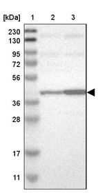 Lane 1: Marker [kDa] 230, 130, 95, 72, 56, 36, 28, 17, 11_br/_Lane 2: Human cell line RT-4_br/_Lane 3: Human cell line U-251MG sp