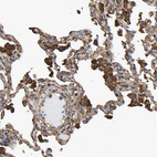 Immunohistochemical staining of human lung shows strong cytoplasmic positivity.