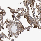 Immunohistochemical staining of human lung shows strong cytoplasmic positivity.