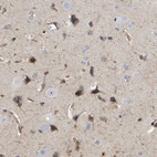 Immunohistochemical staining of human cerebral cortex shows moderate positivity.