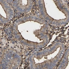 Immunohistochemical staining of human endometrium shows strong positivity in cilia.