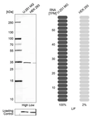 Western blot analysis in human cell lines U-251MG and HEK293 using Anti-LIF antibody. Corresponding LIF RNA-seq data are presented for the same cell lines. Loading control: Anti-HSP90B1.