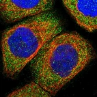 Immunofluorescent staining of human cell line A-431 shows localization to cytosol.