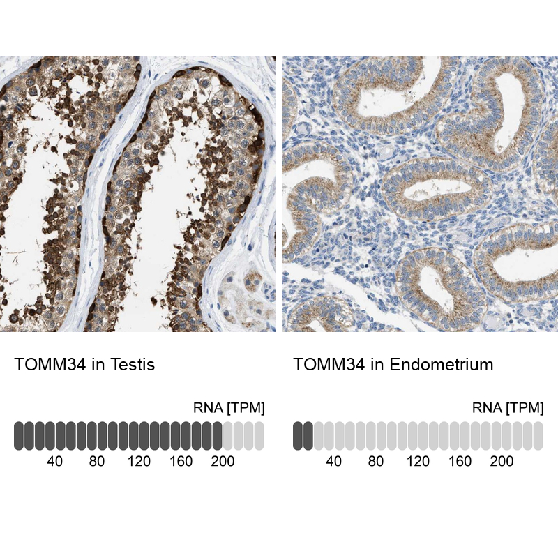 Anti-TOMM34 Antibody
