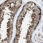 Anti-TOMM34 Antibody