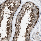 Immunohistochemical staining of human testis shows high expression.