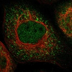 Immunofluorescent staining of human cell line A-431 shows localization to nucleoplasm & cytosol.