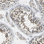 Anti-CSDE1 Antibody
