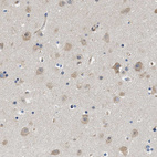 Immunohistochemical staining of human cerebral cortex shows moderate cytoplasmic positivity in neurons.