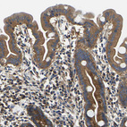 Immunohistochemical staining of human duodenum shows moderate cytoplasmic positivity in glandular cells.