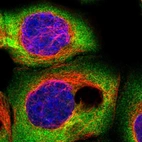 Immunofluorescent staining of human cell line A-431 shows positivity in cytoplasm.