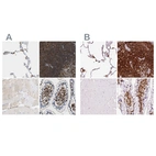 Immunohistochemical staining of human lung, lymph node, skeletal muscle and small intestine using Anti-EVL antibody HPA018849 (A) shows similar protein distribution across tissues to independent antibody HPA019536 (B).