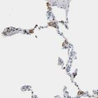 Immunohistochemical staining of human lung shows moderate to strong cytoplasmic positivity in macrophages.