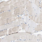 Immunohistochemical staining of human skeletal muscle shows no positivity in myocytes as expected.