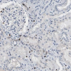 Immunohistochemical staining of human kidney shows no positivity in cells in tubules as expected.