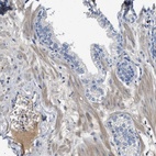 Anti-C1S Antibody