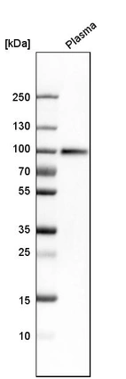 Western blot analysis in human plasma.