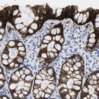 Immunohistochemical staining of human colon shows strong membranous positivity in glandular cells.