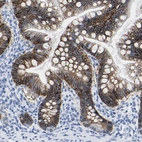 Immunohistochemical staining of human small intestine shows strong membranous positivity in glandular cells.