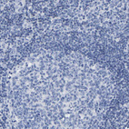 Anti-GPA33 Antibody