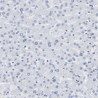 Immunohistochemical staining of human liver shows no positivity in hepatocytes as expected.