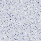 Anti-GPA33 Antibody