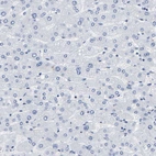 Immunohistochemical staining of human liver shows no positivity in hepatocytes as expected.