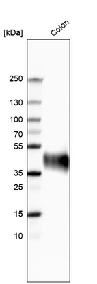 Western blot analysis in human colon tissue.