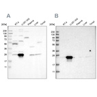 Western blot analysis using Anti-BAG2 antibody HPA018862 (A) shows similar pattern to independent antibody HPA019918 (B).