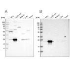 Western blot analysis using Anti-BAG2 antibody HPA018862 (A) shows similar pattern to independent antibody HPA019918 (B).